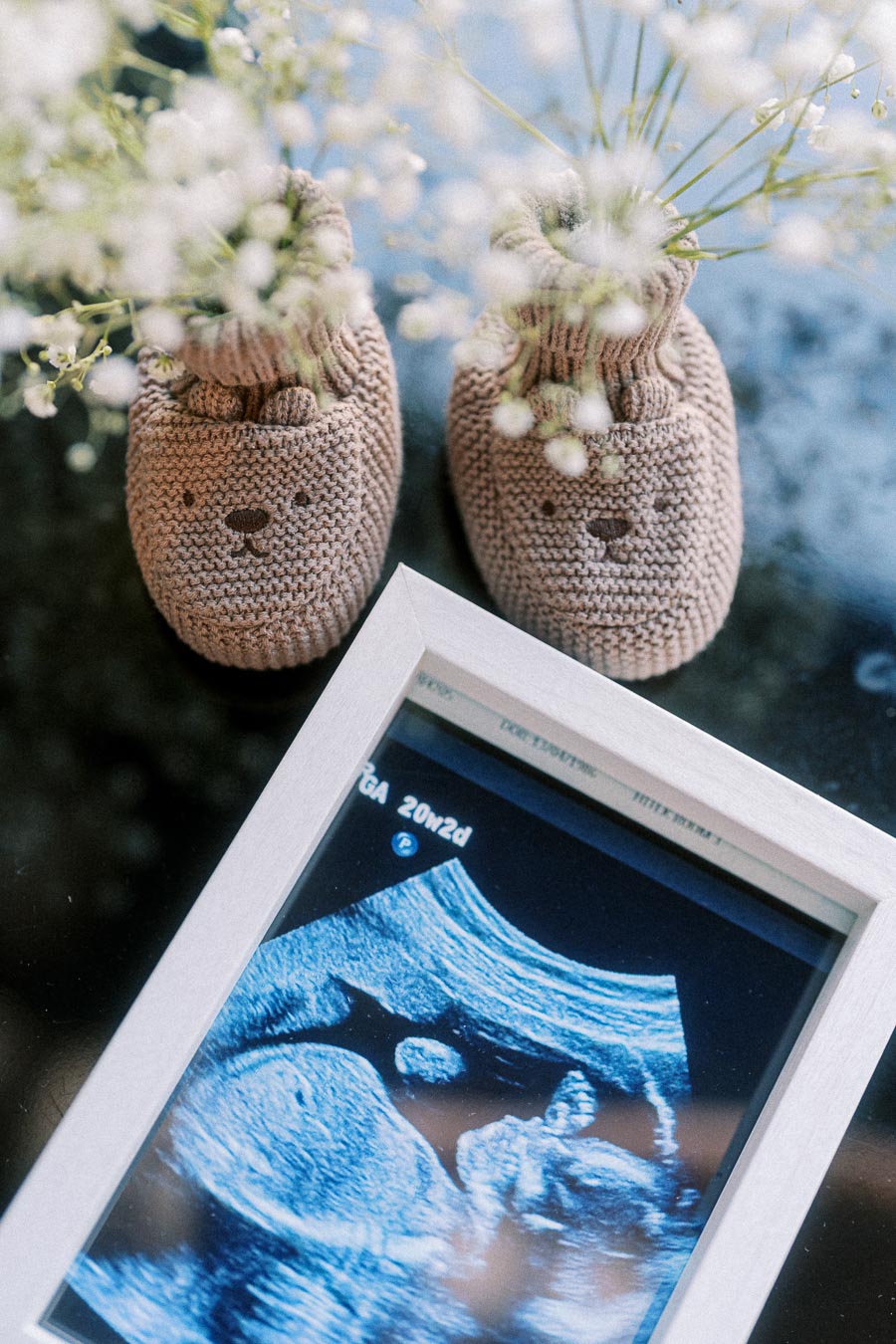 A pair of cute knitted baby booties next to a framed ultrasound image, symbolizing anticipation and celebration of a new baby.