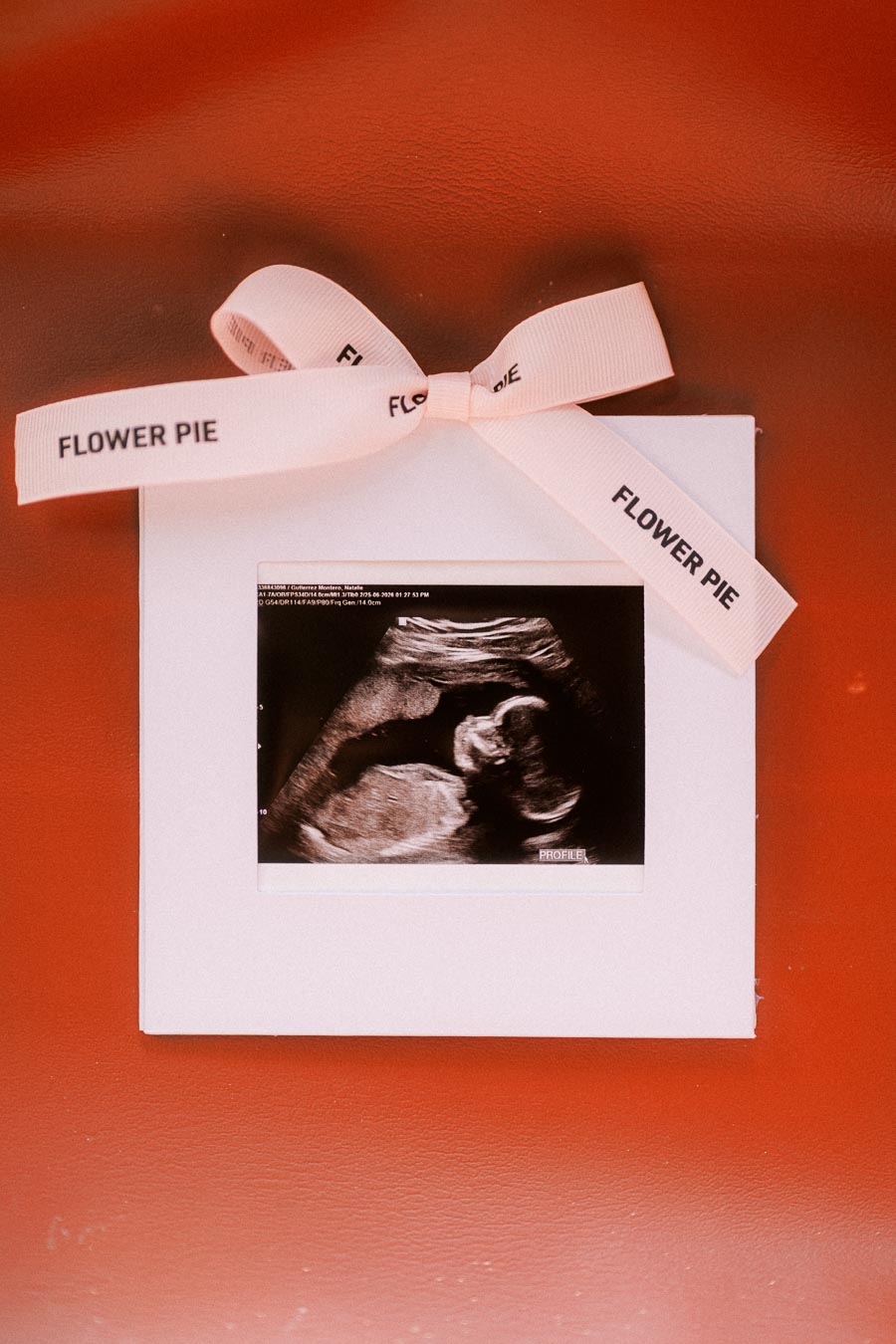 Ultrasound print on a white card tied with a Flower Pie ribbon.